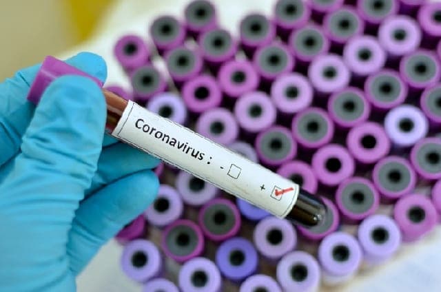 confirmed Covid-19 cases in Ghana now 566